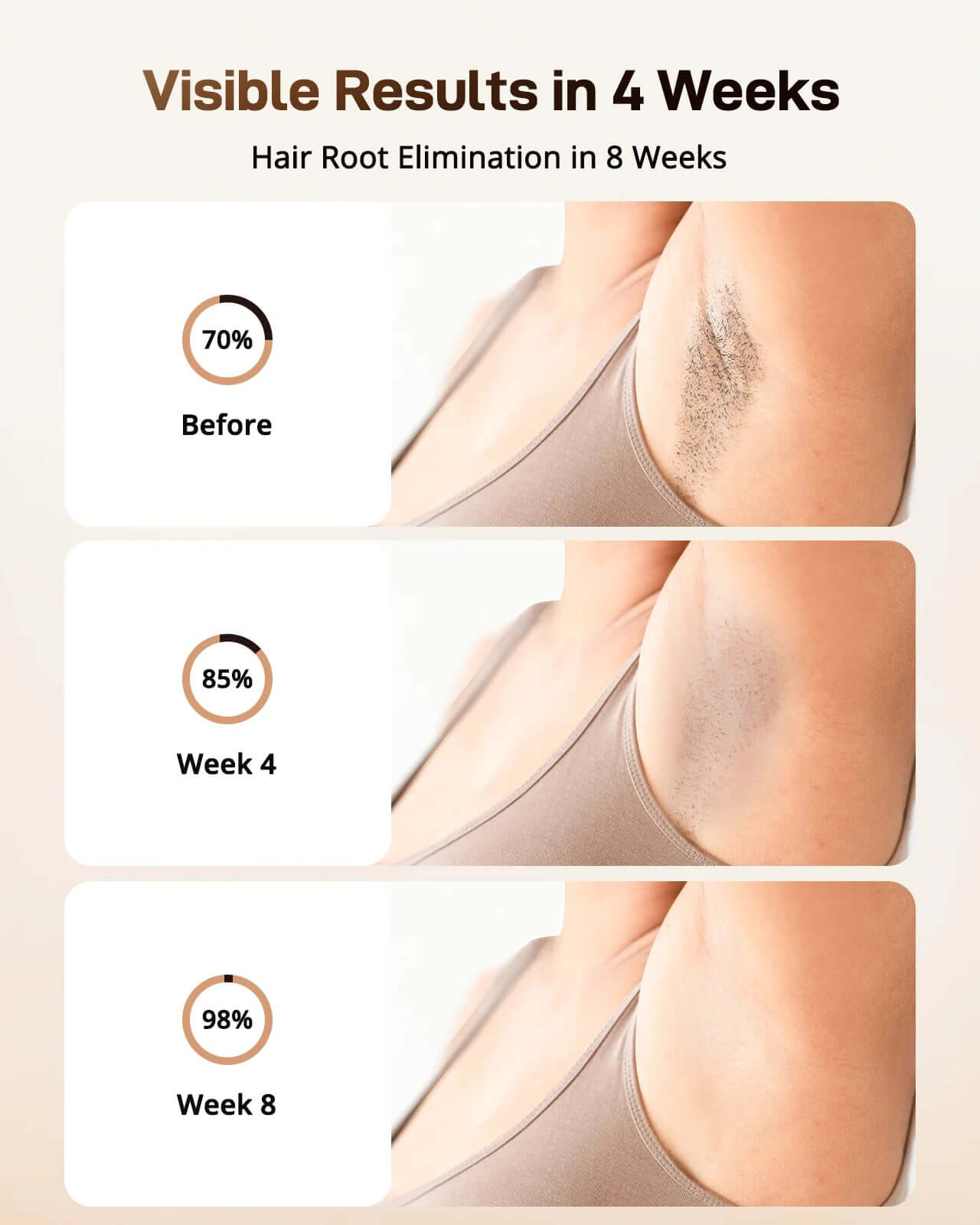 LasTec IPL Hair Removal - NEESTEC